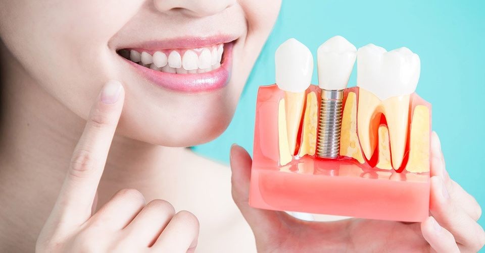 Tooth Loss May Affect Ability To Carry Out Everyday Tasks My Best Dentists Journal Mybestdentists