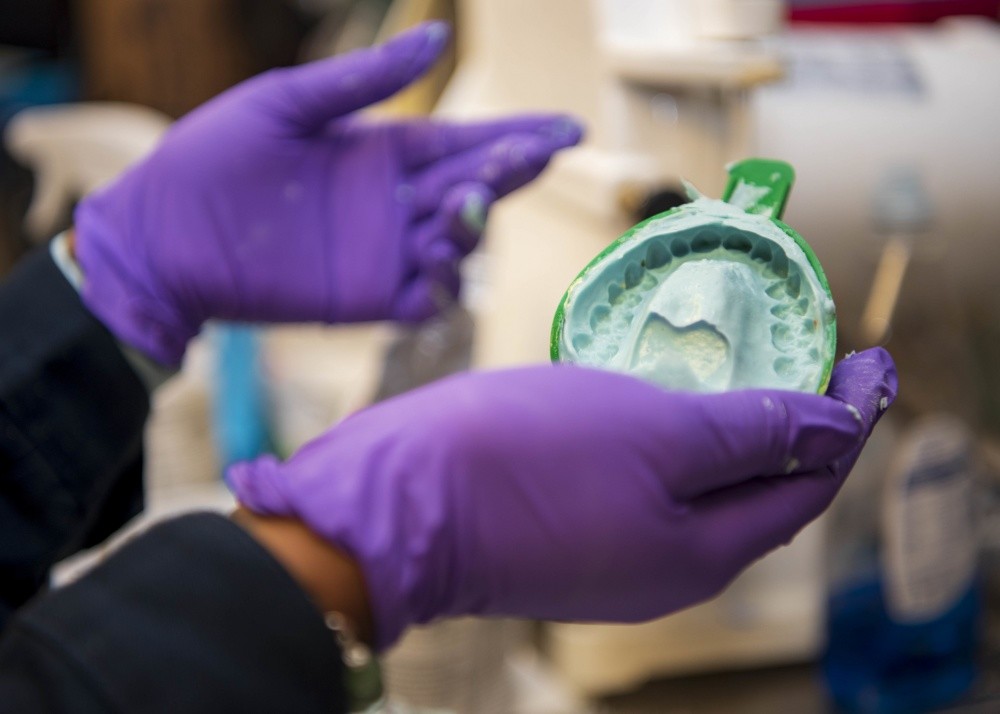 What Is An Alginate Impression? My BEST Dentists Journal MyBestDentists