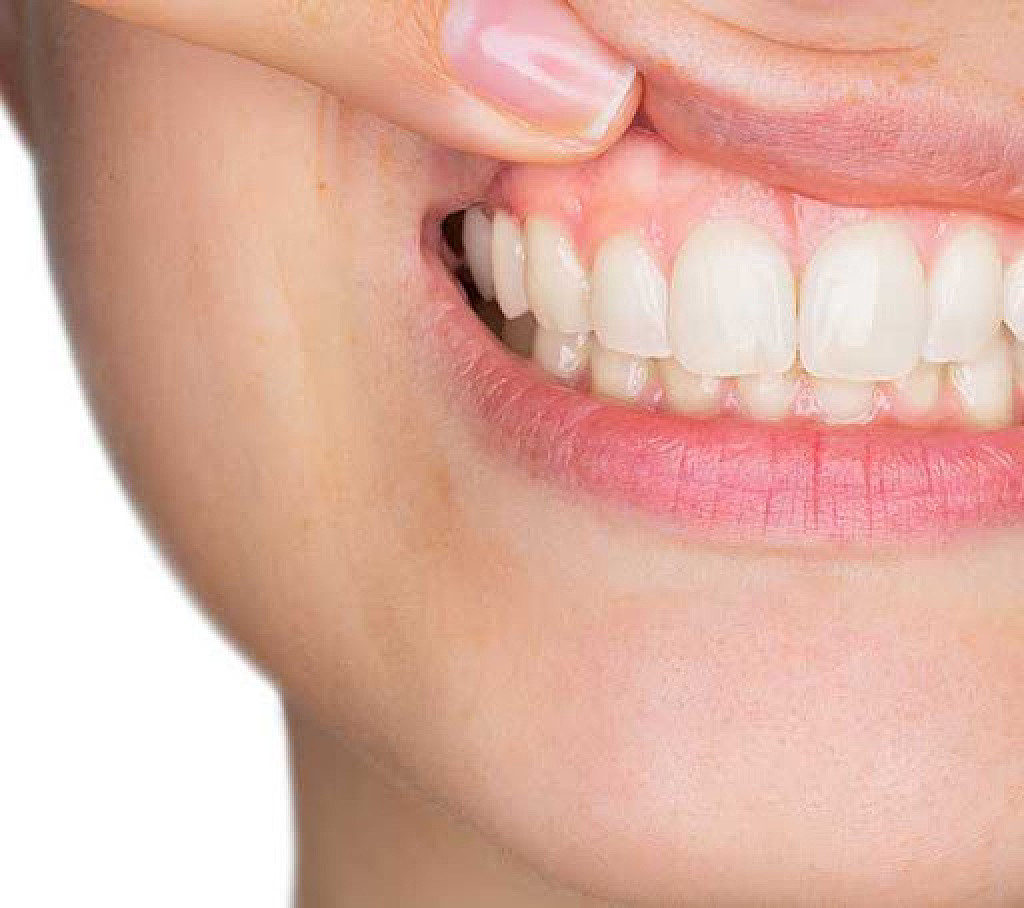 What Causes Pale Gums? My BEST Dentists Journal MyBestDentists